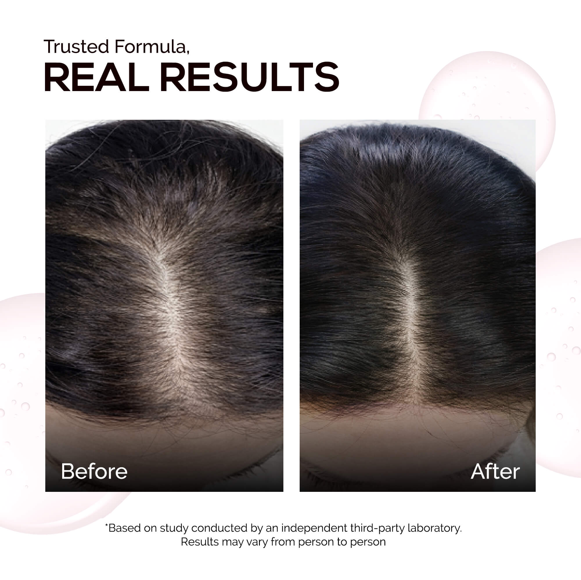 KORE Anti Hairfall Multi-Peptide Shampoo + Conditioner Duo