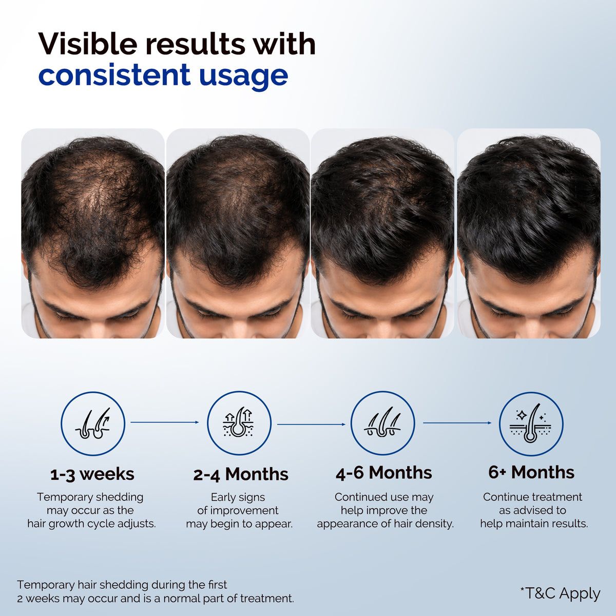 KORE 10% Minoxidil and 0.1% Finasteride Lipid Topical Solution