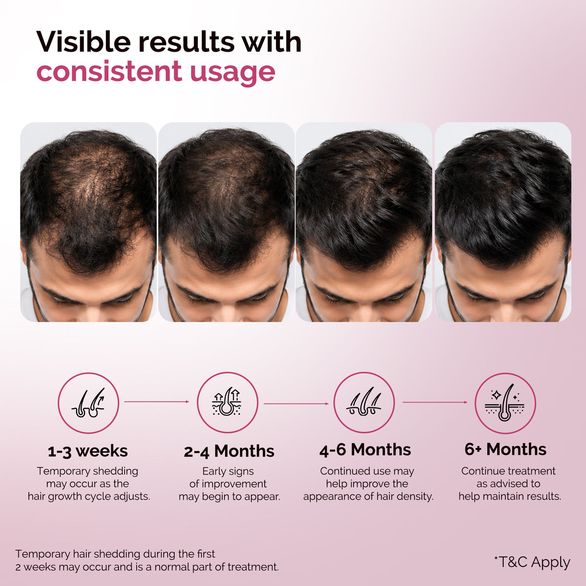KORE Hair Growth Treatment | 2% Minoxidil Lipid Topical Solution | 60 ml