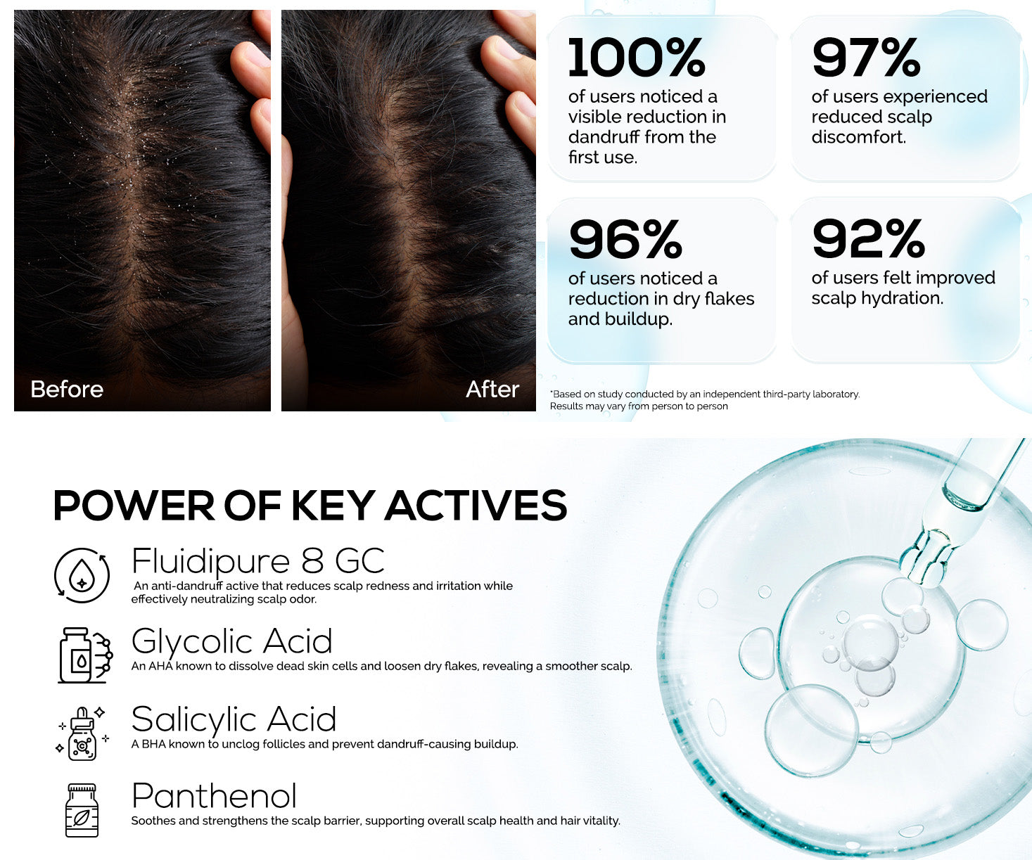 KORE Pre-Shampoo Anti-Dandruff Scalp Detox Serum