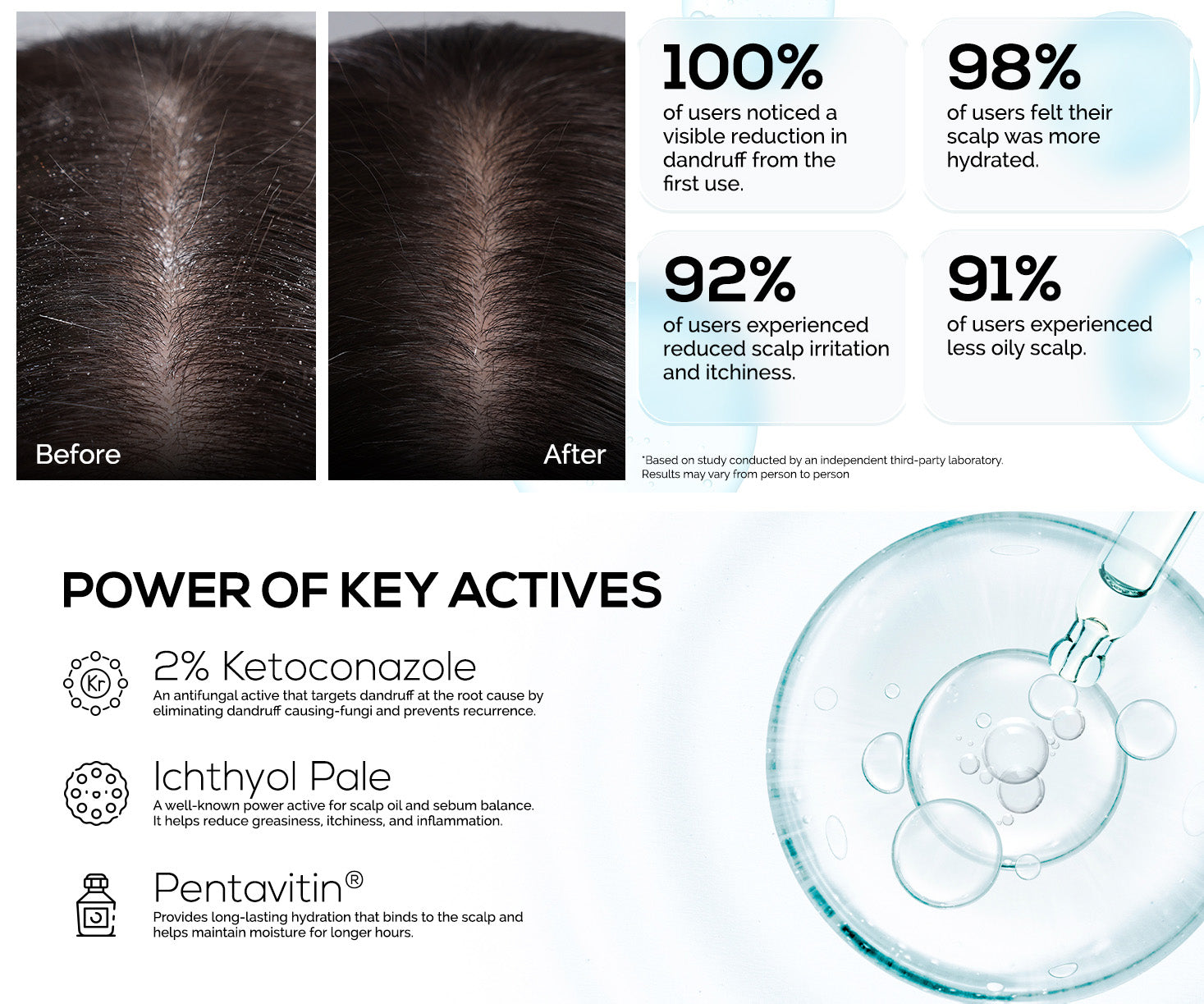 KORE Anti-Dandruff 2% Ketoconazole Hydrating Shampoo